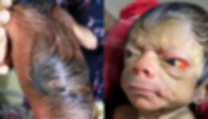 Bayi ini Terlahir Dengan Paras yang Tak Biasa.