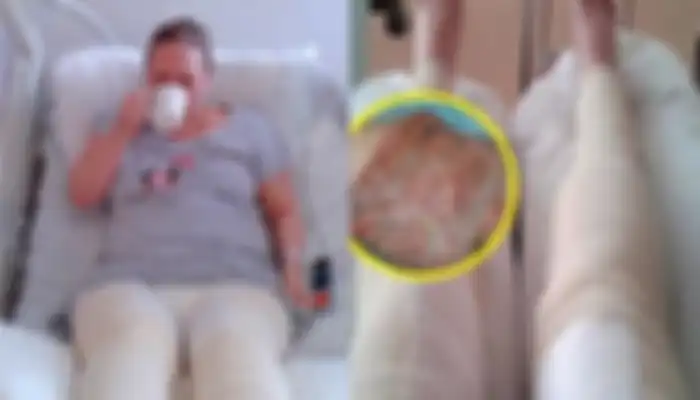 Wanita ini Koma 9 Hari dan Nyaris Meninggal Usai Cukur Bulu Kemaluannya
