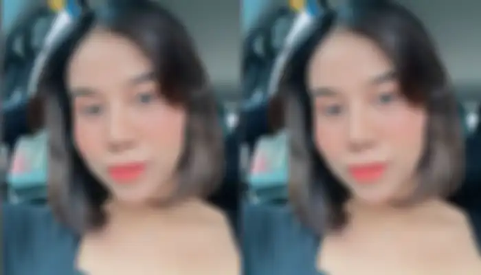 Mayang Lucyana pamerkan hasil operasi hidung. Akui sempat bersikap manja ke dokter.