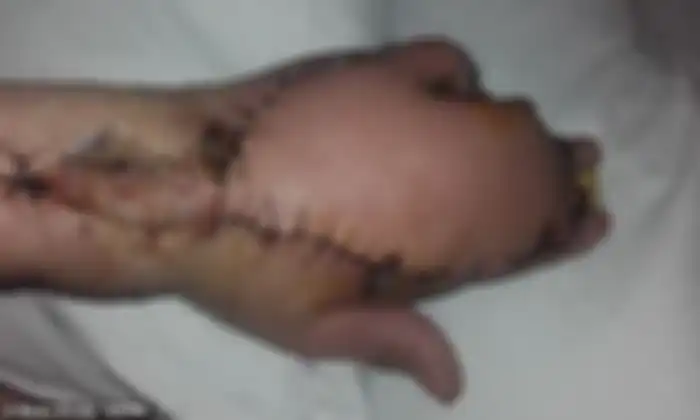 Dokter mengatakan ia masih beruntung karena nyawanya bisa selamat