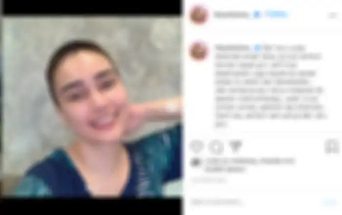 Feby Febiola pangkas habis rambutnya karena efek kemoterapi.