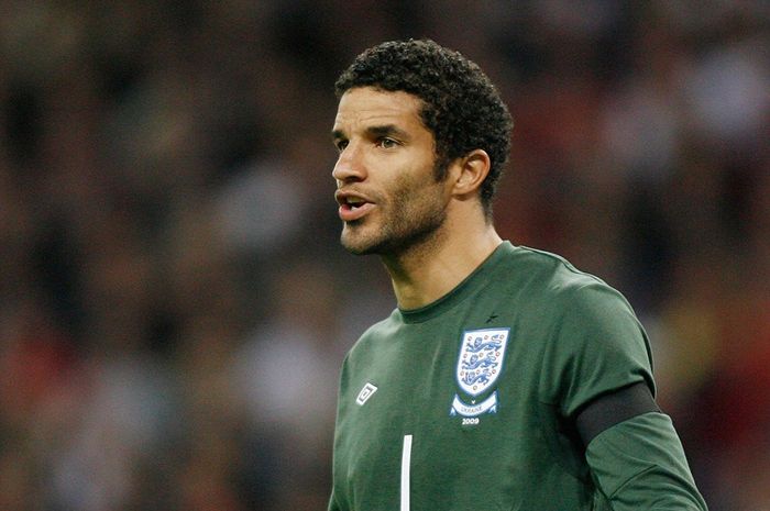 Mantan penjaga gawang Manchester City dan Liverpool, David James.