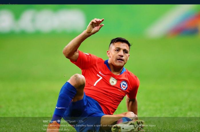 Alexis Sanchez alami cedera saat memperkuat timnas Cile.