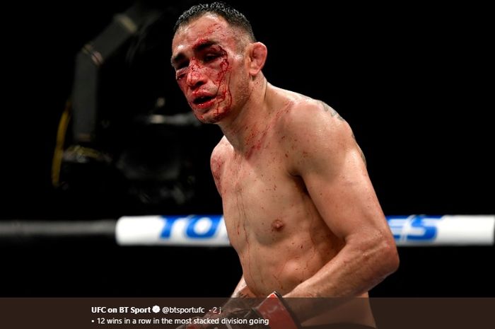 Petarung UFC asal Amerika Serikat, Tony Ferguson.