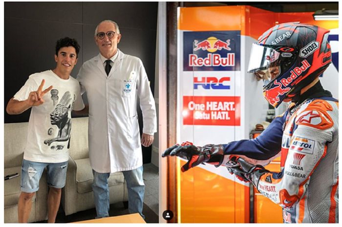 Marc Marquez puas usai cedera patah lengan kanannya ditangani tim dokter di Barcelona. Pebalap Repsol Honda itu sempat merasakan lengan kanannya sehari sebelum lomba MotoGP Andalusia 2020. 