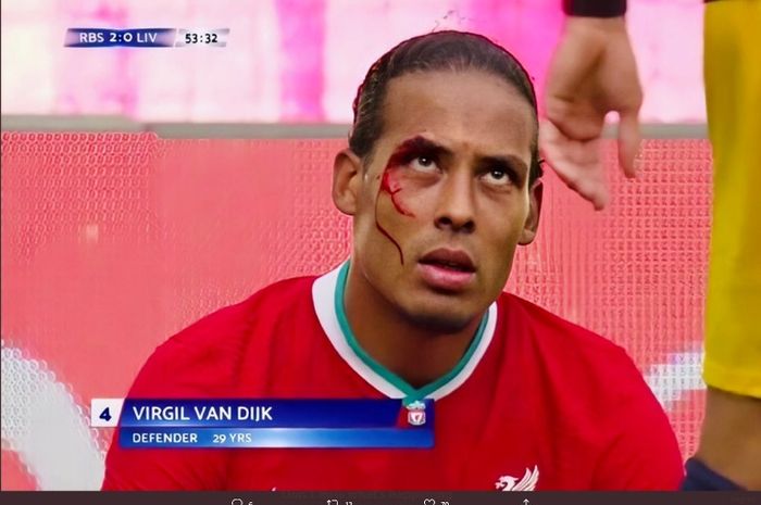 Bek Liverpool, Virgil van Dijk, mengalami cedera dalam laga uji coba melawan RB Salzburg di Red Bull Arena, Selasa (25/8/2020).