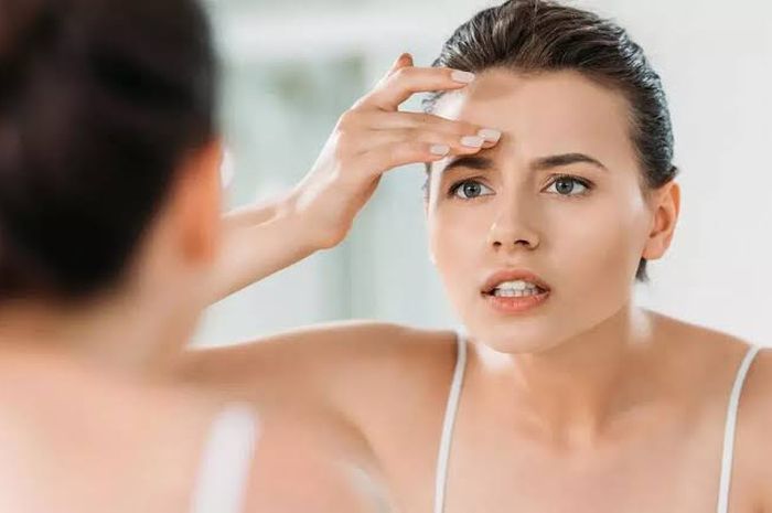 Ini dia bahaya menggunakan pasta gigi pada jerawat!