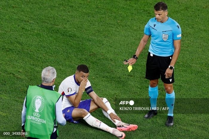 Kylian Mbappe mendapatkan kartu kuning dan hidungnya mengalami cedera dalam laga Prancis vs Austria di Grup D EURO 2024, Senin (17/6/2024) di Duesseldorf.