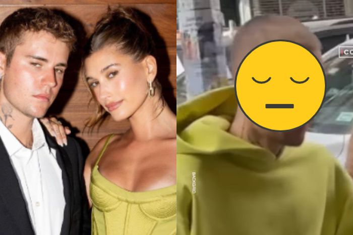 Justin Bieber tampak lebih kurus