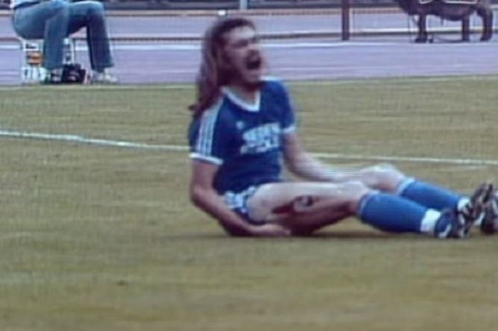 Paha gelandang Arminia Bielefeld, Ewald Lienen, sobek saat ditekel keras oleh bek Werder Bremen, Norbert Siegmann, dalam laga Liga Jerman pada 14 Agustus 1981