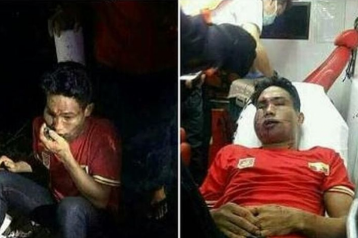 Suporter timnas sepak bola Myanmar dipukuli Ultras Malaysia.