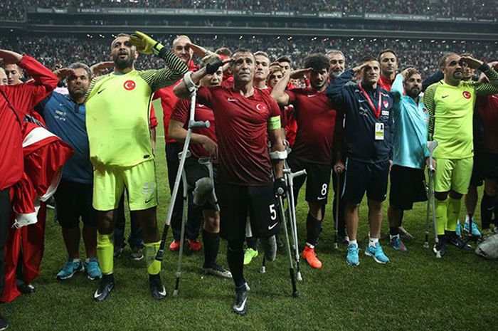 Timnas sepak bola difabel Turki menjadi juara European Amputee Football Federation (EAFF) Championship usai menang 2-1 atas Inggris pada, Senin (10/10/2017) di Istanbul's Vodafone Park, Turki.