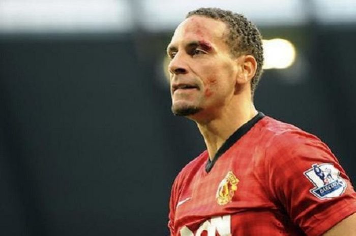  Pelipis Rio Ferdinand berdarah setelah dilempar koin oleh fan Manchester City dalam pertandingan derbi Manchester, Minggu (9/12/2012). 