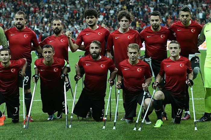 Timnas sepak bola difabel Turki menjadi juara European Amputee Football Federation (EAFF) Championship usai menang 2-1 atas Inggris pada, Senin (10/10/2017) di Istanbul's Vodafone Park, Turki.