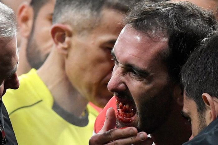 Diego Godin usai bertabrakan dengan kiper Valencia, Neto, saat Atletico Madrid berhadapam dengan Valencia, Senin (5/2/2018)