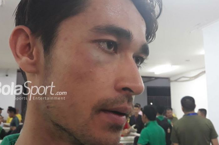 Pemain Timnas Indonesia, Gavin Kwan Adsit, menerima luka memar di mata kanannya usai melawan timnas 