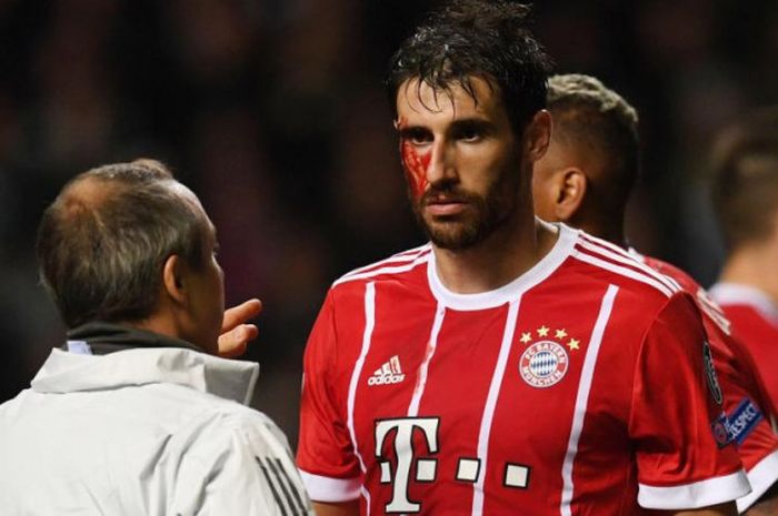 Muka Javi Martinez berlumuran darah setelah berbenturan dengan  Nirr Bitton dalam pertandingan Bayern Muenchen vs Celtic, Rabu (1/11/2017)