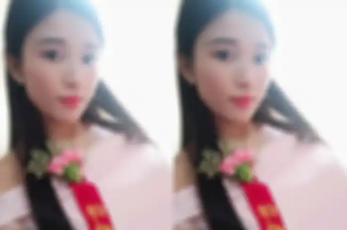 Min Wenqing harus diamputasi kakinya