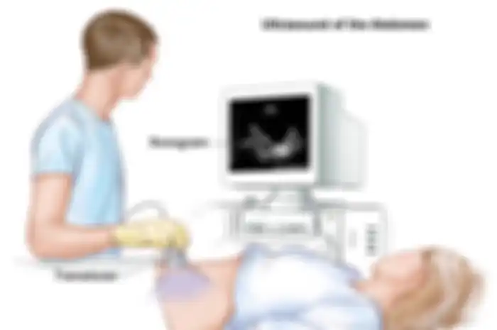 Hari ini memperingati Hari Kanker Sedunia. Mari kita mengenal kanker peritoneal, bagaimana diagnosis dan perawatannya. 