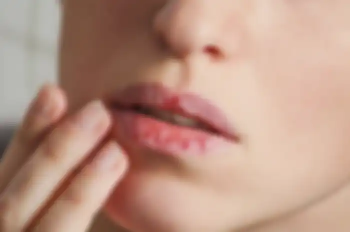 Bibir kering
