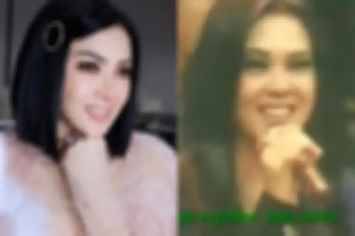 Perbedaan bentuk hidung Syahrini dulu dan sekarang