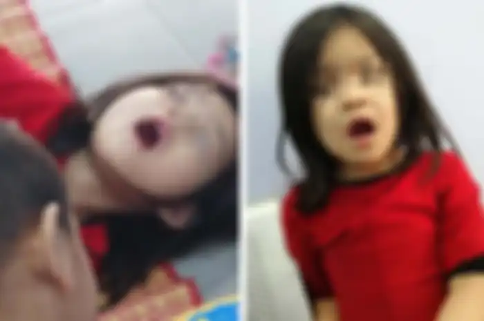 Anak Husnulkhotimah Fahmi, Nashwa nggak bisa menutup mulut karena bibirnya mengalami kejang usai menggigit Daun Bahagia 