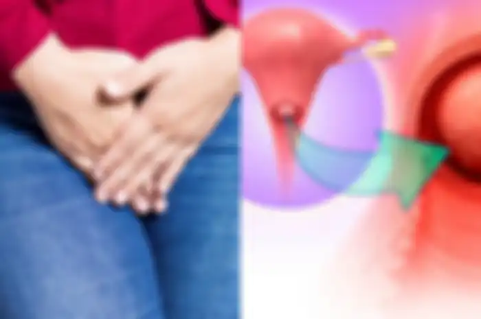 Menurut WHO, diperkirakan ada 570.000 kasus kanker serviks pada 2018, sama dengan 6,6 persen dari keseluruhan kasus kanker pada wanita.