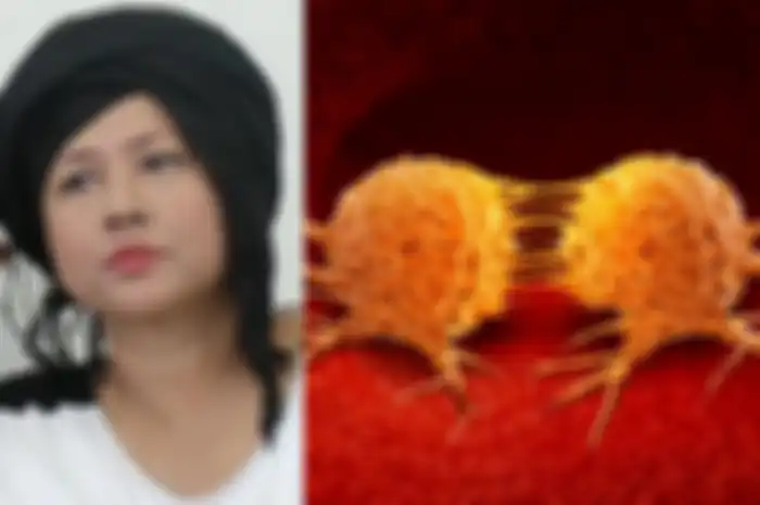 Artis Ria Irawan alami metastasis, kebiasaan tidur yang satu ini bisa picu perkembangan dan penyebaran sel kanker.