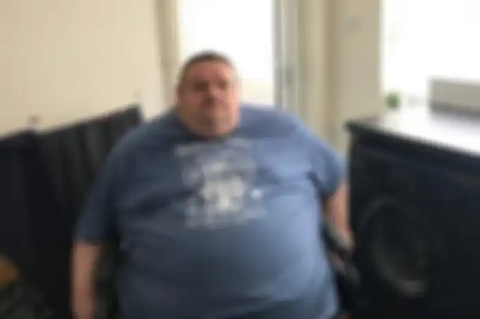 obesitas