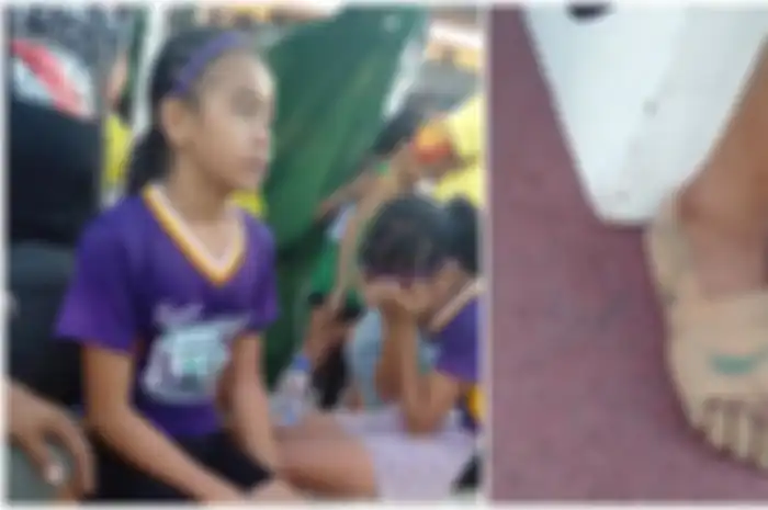 Rhea Bullos yang hanya balut kakinya pakai perban saat lomba lari