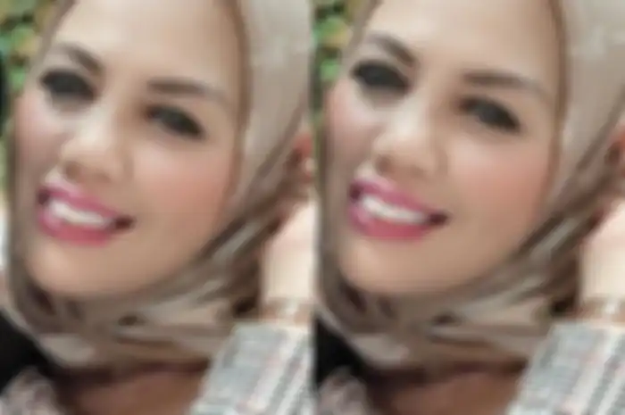 Potret penmapilan baru Elly Sugigi dengan bentuk gigi yang lebih rapi hingga bikin netizen pangling