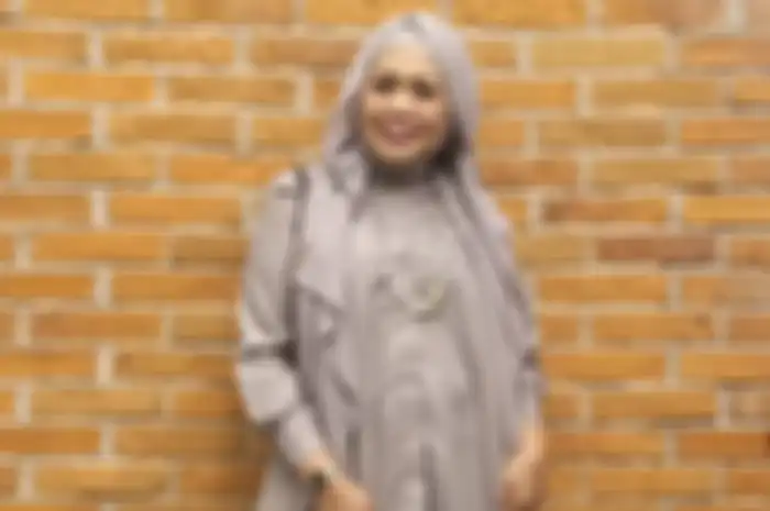 Melihat potret penmapilan baru Elly Sugigi dengan bentuk gigi yang lebih rapi hingga bikin netizen pangling