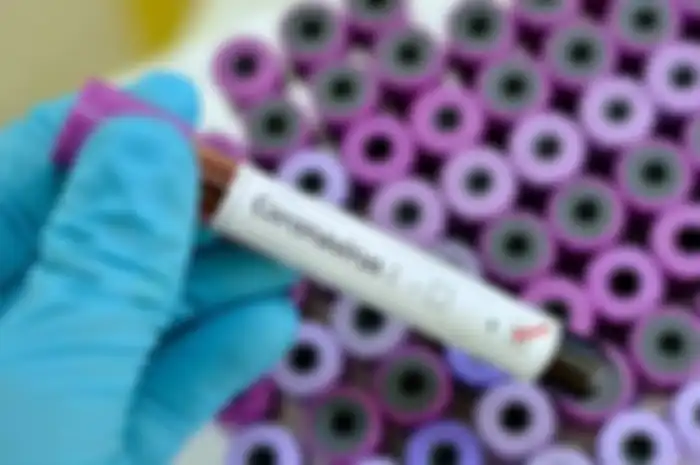 Virus Corona telah dianggap sebagai darurat kesehatan masyarakat internasional pada 30 Januari 2020 silam.