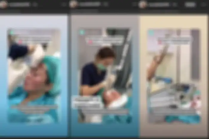 Muzdalifah tengah lakukan suntuk botox