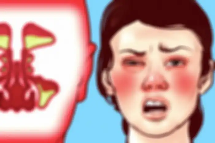 Tahukah Anda bagaimana cara mengatasi hidung tersumbat?

Hidung tersumbat atau mampet membuat kita tidak nyaman.