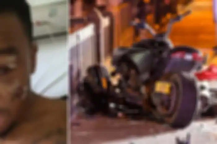 Bugzy Malone showed his injuries 