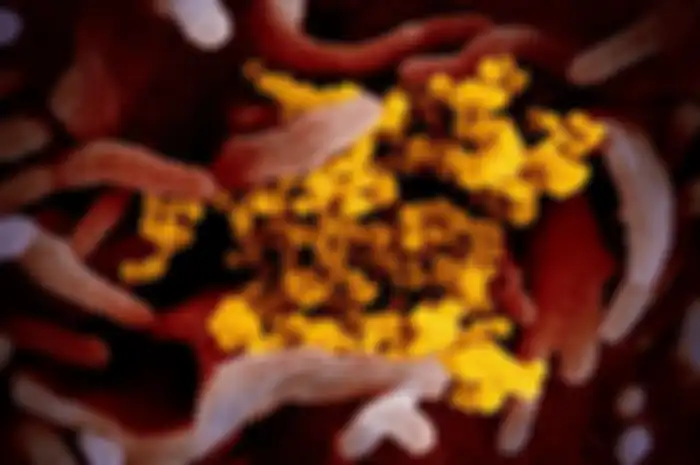 Gambar mikroskop elektron pemindai ini menunjukkan virus corona Wuhan atau Covid-19 (kuning) di antara sel manusia (merah). Sampel virus diambil dari seorang pasien AS yang terinfeksi. Para ahli menambahkan gambar agar lebih tampak
