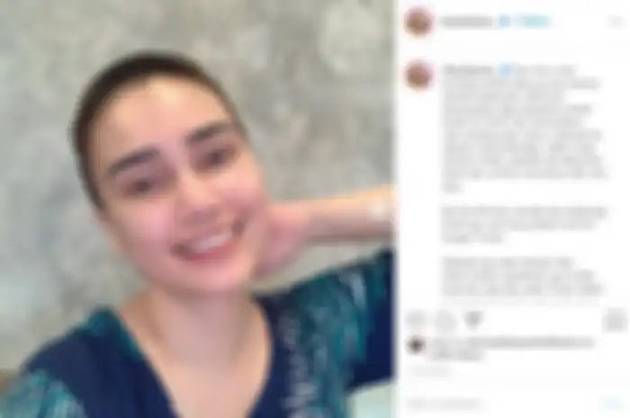 Potret Feby Febiola yang nyaris botak 
