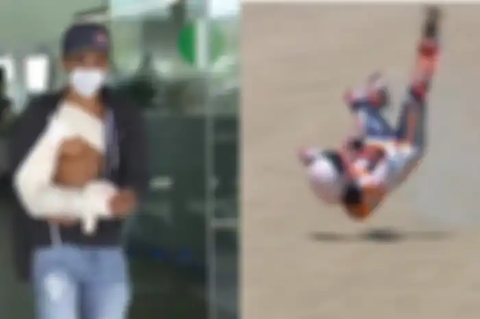 Babak belur di MotoGP Spanyol 2020, kapan Marc Marquez bisa balapan lagi?