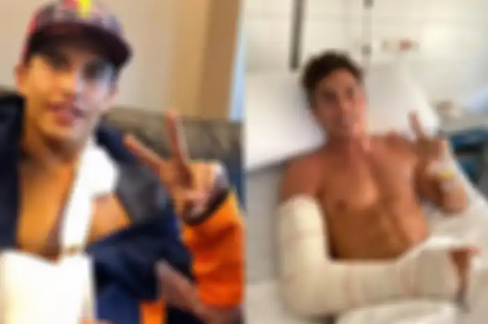 Jelang MotoGP Ceko 2020, Marc Marquez dioperasi lagi, ada apa ya?