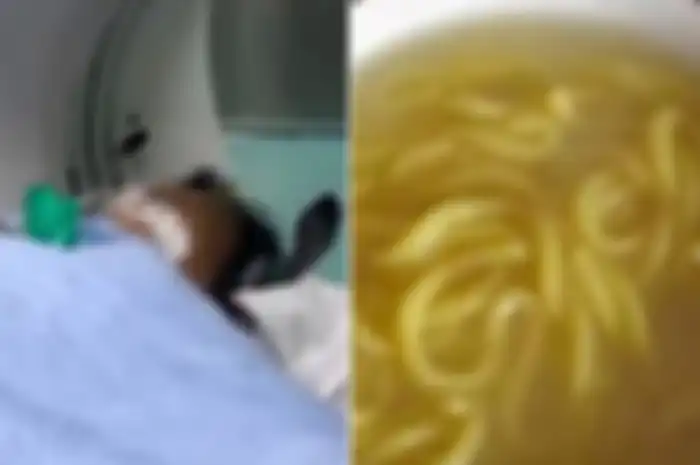 Salah satu korban keracunan akibat memakan mi berusia satu tahun di Heilongjiang, China. Sebanyak 9 anggota keluarga meninggal setelah memakan mi buatan sendiri yang terkontaminasi asam bongkrek.