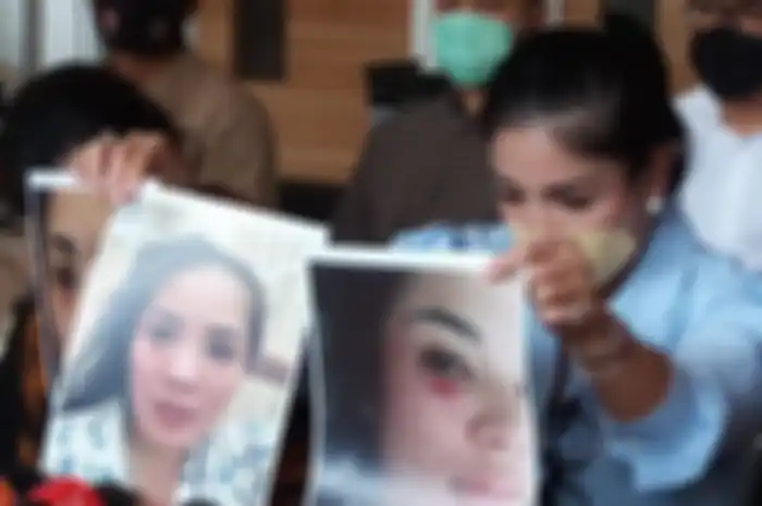 Nindy Ayunda menunjukkan foto-foto lebam pada wajahnya akibat kekerasan dari suaminya, Askara Parasady, di kantor Komnas Perempuan, Jakarta, Selasa (16/2/2021).