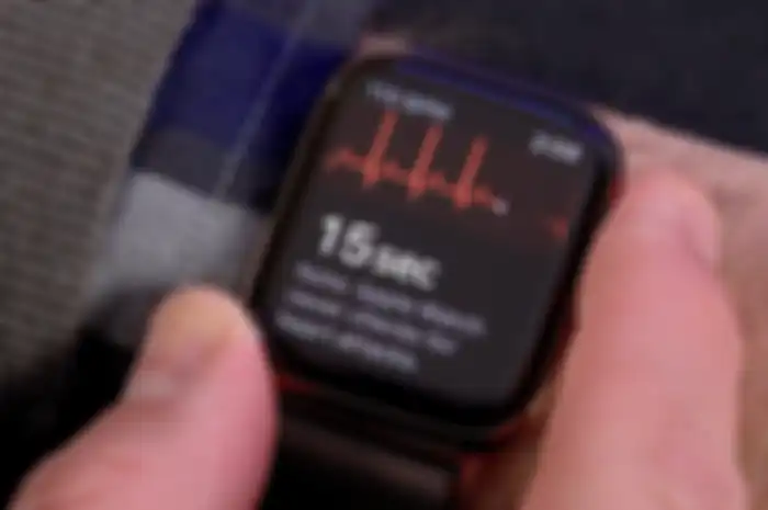 Fitur Ecg di Apple Watch