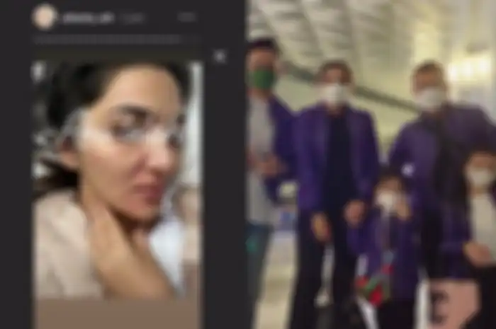 Foto Ashanty gatal-gatal di seluruh badan hingga memutuskan pergi berobat ke Turki bersama Anang Hermansyah dan ketiga anaknya.