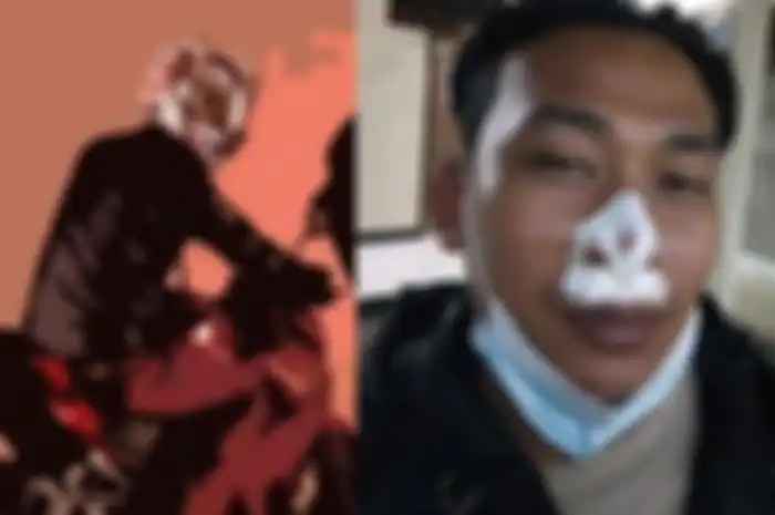 Hidung Luka Bibir Dijahit, Bripka Firman Terseret Motor Saat Lawan Kawanan Penjahat
