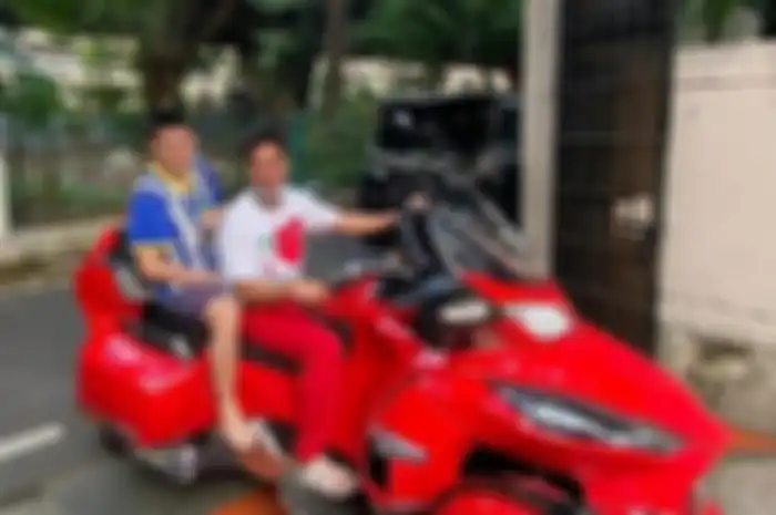Terjatuh dari sepeda motor, ternyata ada salah satu saraf di pergelangan tangan artis Baim Wong yang terputus.
