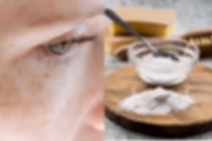 Flek hitam bisa diusir hanya dengan baking soda