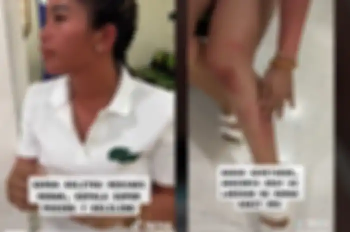 Kondisi badan Farida Nurhan yang merah-merah