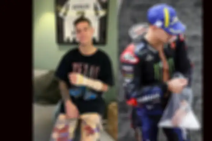 Fabio Quartararo cedera lengan kiri gara-gara insiden crash saat latihan motocross baru-baru ini (kiri) dan Fabio Quartararo cedera jari tengah kiri di MotoGP Malaysia 2022 Oktober lalu (kanan) beruntung kedua cedera itu tak perlu naik meja operasi
