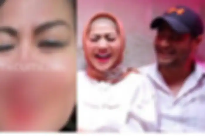 Venna Melinda dan Ferry Irawan.